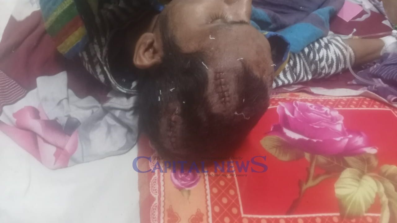 Youth attacked with Iron Rod during break-in, accused still at large, family in fear 