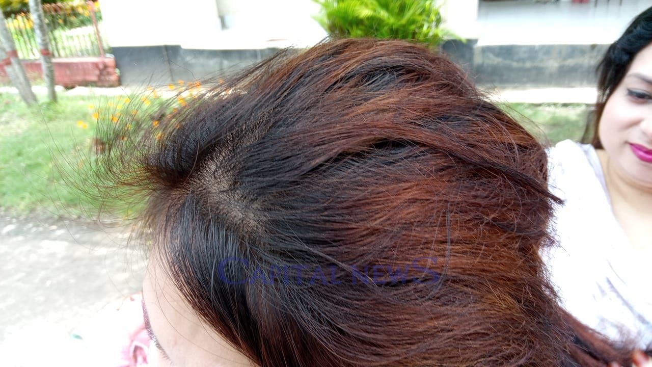 School teacher alleges severe hair damage at beauty parlour, files complaint