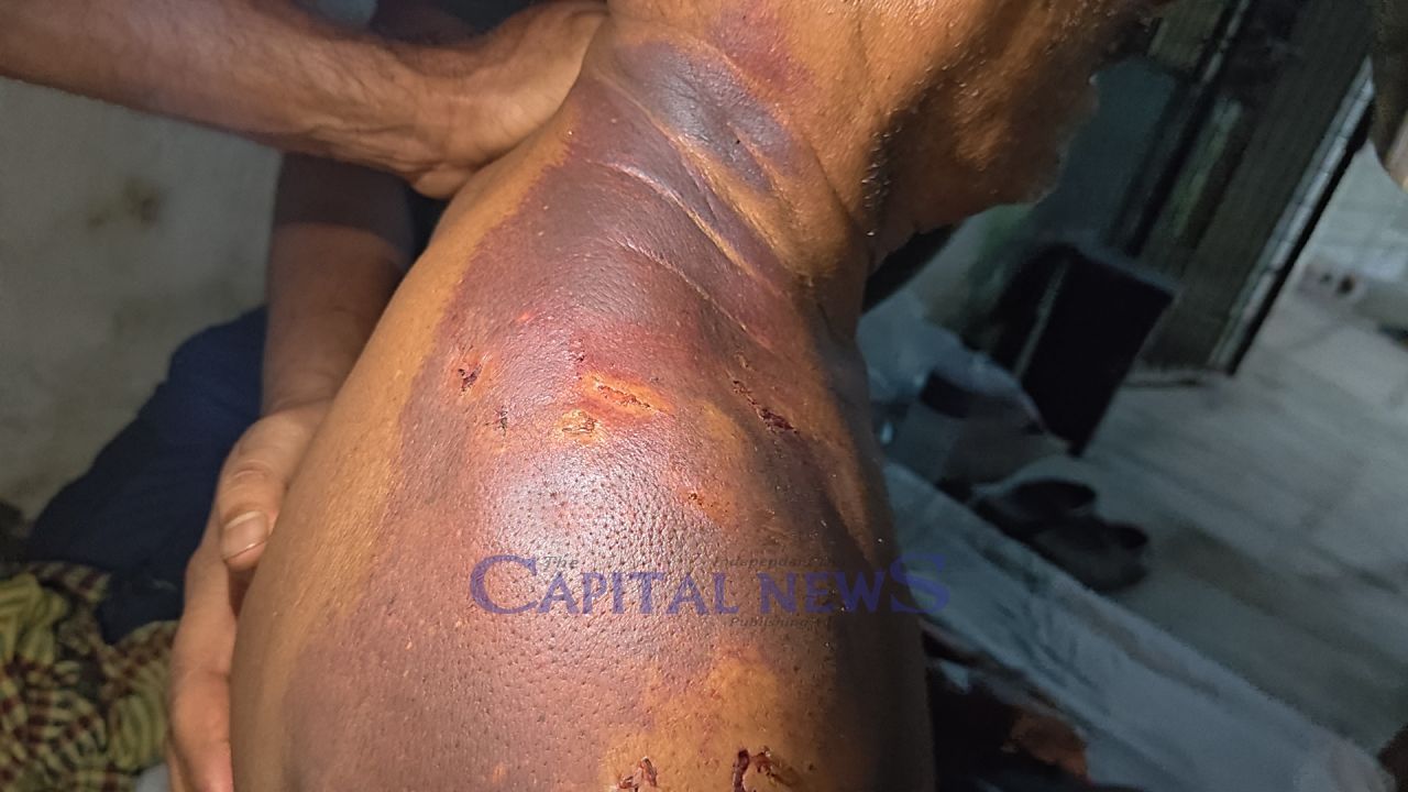 Oman expat allegedly beaten, confined at home  for five days by wife and sons in Lakshmipur